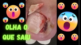 Compilado de UNHAS ENCRAVADAS VIDEOS SATISFATÓRIOS [upl. by Roma]