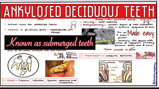 ANKYLOSED DECIDUOUS TEETH  SUBMERGED TEETH  Oral pathology [upl. by Bethena105]