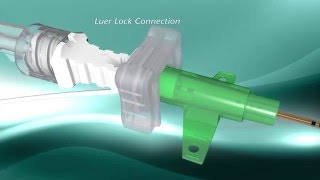 PAJUNK E Cath Product Features Animation  RichardsMedicalcom [upl. by Lramaj805]