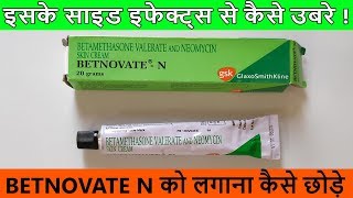 Betnovate N Cream को लगाना कैसे छोड़े  Side Effects से कैसे उबरे [upl. by Chloras]