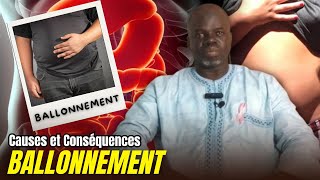 Ballonnement P01  Causes et Conséquences   Pr Ousmane Ndiaye  LansarrTV [upl. by Sabelle542]