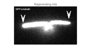 biosights January 19 2015  Tubulin transport pumps up cilia [upl. by Etnor]