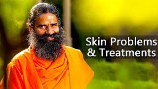 Skin Problems amp Treatments  Swami Ramdev [upl. by Taggart]