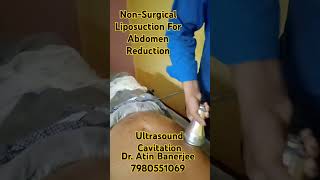 NonSurgical Liposuction for abdomen Reduction by Ultrasound Cavitation Dr Atin Banerjee abdomen [upl. by Euell]