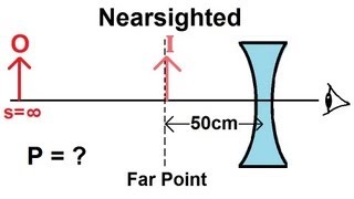 Physics  Optics Vision Correction 2 of 5 Nearsighted [upl. by Denton]