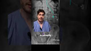 Abdominal Xray Mnemonic TOOB Full Video in description 🔽 [upl. by Ennagroeg603]