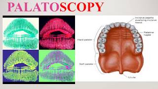 Cheiloscopy and Palatoscopy [upl. by Eneleh855]