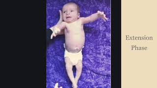 Moro Reflex in Lifelong Development [upl. by Anelah]