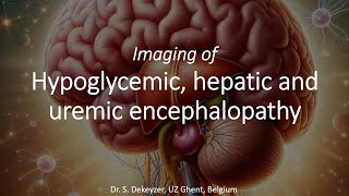 Imaging of ToxicMetabolic Brain Disorders hypoglycemic hepatic amp uremic encephalopathy [upl. by Dorisa]