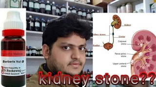 Homeopathic medicine for kidney stone explain [upl. by Yennep]