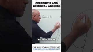 Cerebritis And Cerebral Abscess drnajeeb drnajeeblectures shortvideostatus [upl. by Haggai]