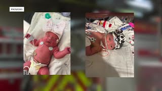 Its been tough  Newborns of two Coweta firefighters recovering from surgery [upl. by Binni]