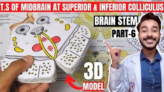 transverse section of midbrain at level of superior colliculus and inferior colliculus [upl. by Maridel123]