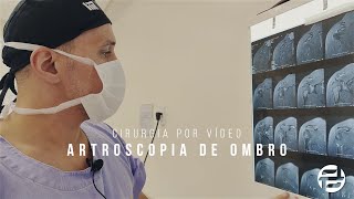 Cirurgia bem sucedida de uma paciente com Lesão Supraespinhal no Tendão do Ombro paciente de 36 anos [upl. by Sapienza]