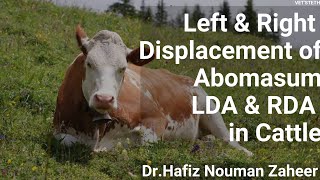 Displacement of AbomasumLDARDATreatment protocolComplete Lecture By Dr Hafiz Nouman Zaheer [upl. by Adara]