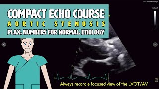 〖Echocardiography〗 Aortic stenosis  principles normal values amp the LVOT 🫀 [upl. by Niar85]