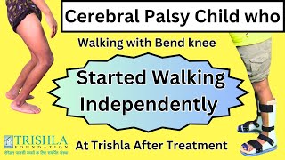 Dystonic Diplegic Cerebral Palsy with Crouch Gait got Excellent Walking Capability after treatment [upl. by Zhang325]