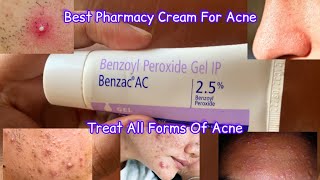 Benzac AC Cream Review  benzac ac 25 review  Benzoyl Peroxide For Acne [upl. by Anikahs]