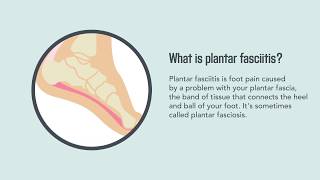 Plantar Fasciitis Causes Symptoms and Treatment  Merck Manual Consumer Version [upl. by Yvonner44]