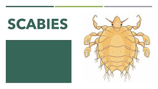 Scabies Lecture [upl. by Notyep949]