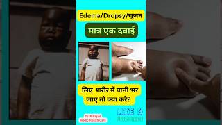 Edema  शरीर में सूजन  Ferrum met 30 homeopathic [upl. by Ahsinirt]