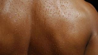 Embarrassing Problem  Excess Sweating  Ayurveda  Dr Sumita Prajapati [upl. by Channing]