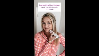 DermaWand Pro Review  Neck Wrinkle Results in 1 Week [upl. by Tips]