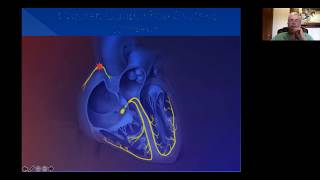 Cardiac Arrhythmia Brief Focused Approach Part 1 Supraventricular Arrhythmia [upl. by Accem15]