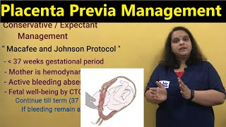 Management of Placenta Previa  Diagnosis Complications amp Management  APH  Nursing Lecture [upl. by Orgalim]