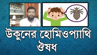 মাথার উকুন দূর করার হোমিওপ্যাথি ঔষধ উপায় চিকিৎসা  Lice homeopathy treatments in bangla [upl. by Juditha]