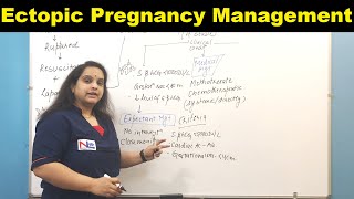 Management of Ectopic Pregnancy  Nursing Lecture [upl. by Jim]