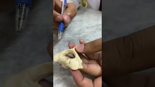 Cervical Vertebrae  Anatomy  2nd Year MBBS [upl. by Eelesor]