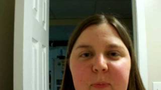 Lupus vlog  Malar rash [upl. by Nancey]