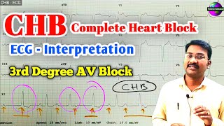 Complete Heart Block ECG  3rd Degree Av Block ECG  CHB ECG pstamil ps [upl. by Lorrimer128]