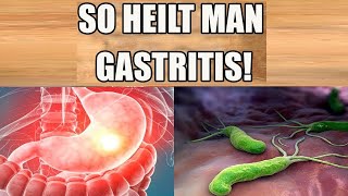 Gastritis heilen Beseitige deine Gastritis schnell und natürlich  Einfaches Heilmittel [upl. by Ydner]