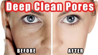 How to Clean Pores  Deep Cleaning Your Pores on Nose  Face Easily [upl. by Melina]