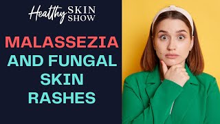 Malassezia And FUNGAL Skin Problems  Dr Julie Greenberg [upl. by Billye]