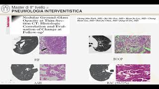 Introduzione alla Pneumologia Interventistica [upl. by Firestone]
