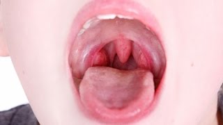 Home Remedy for Tonsils  Health Tips [upl. by Blase]