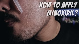 Minoxidil for Beard Growth Week 12 How to Apply Minoxidil [upl. by Aicirtal16]