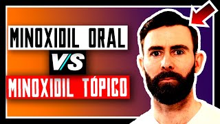 Minoxidil Oral Vs Tópico Para Recuperar El Pelo [upl. by Ilac]