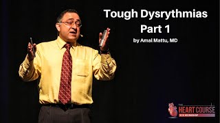 Tough Dysrythmias Part 1  The Heart Course HomeStudy ECG Workshop [upl. by Downe640]