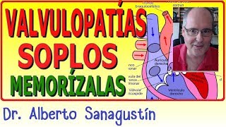 Memoriza las VALVULOPATÍAS y SOPLOS ✅ rápido y fácil [upl. by Conlen]