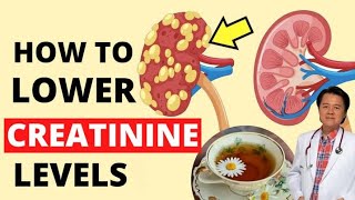 How To Lower Creatinine Levels  Tips for Kidney Disease  By Doc Willie Ong 1364 [upl. by Luther]