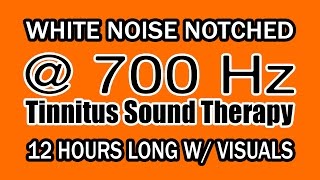 White Noise  Notch Filtered at 700 Hz for Tinnitus Therapy w Visuals [upl. by Tingley]