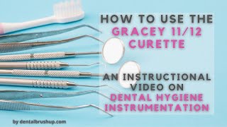 How to use the Gracey 1112 Curette [upl. by Ladnik]