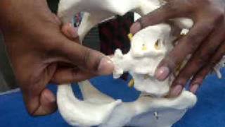 Dr P Senthil Kumar PhD PT Coccyx Mobilization Technique Maitlands Concept for Coccydynia [upl. by Auot]