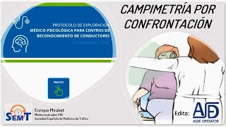 Método de Campimetría por Confrontación [upl. by Ludmilla]