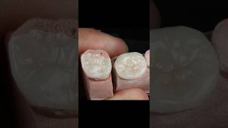 Maquillaje Disilicato de Litio aidite dientes esteticadental [upl. by Ttimme]