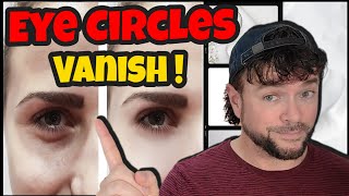 INSTANTLY Make Under Eye Circles Vanish  Chris Gibson [upl. by Ameekahs468]